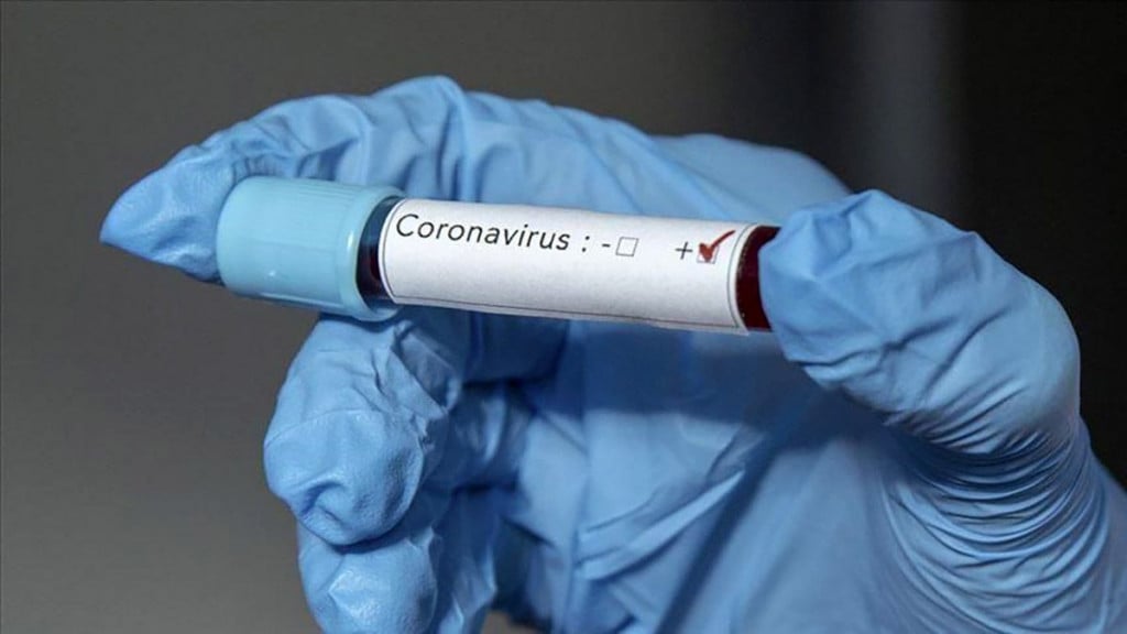 Koronavirus covid 19
